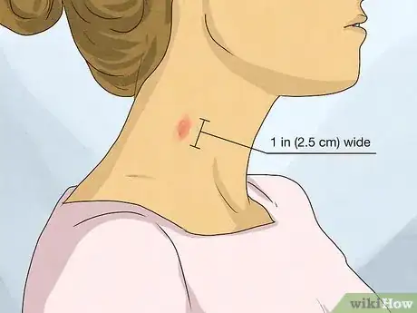 Immagine titolata Identify a Hickey Step 1