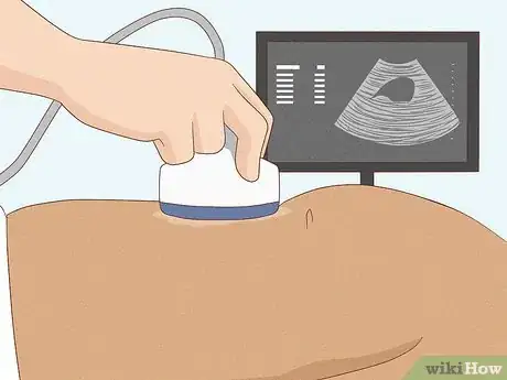 Immagine titolata Get Rid of Gallstones Step 10