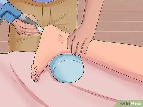 Immagine titolata Treat Plantar Fasciitis Step 10