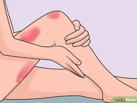Immagine titolata Take an Inch off Your Thighs Step 17