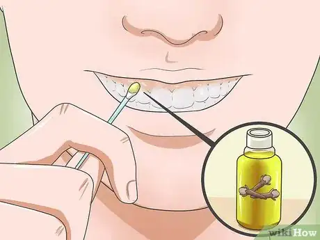 Immagine titolata Reduce Gum Swelling Step 9