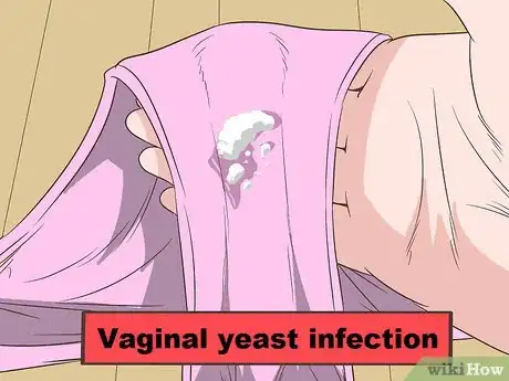 Immagine titolata Tell if Vaginal Discharge Is Normal Step 14