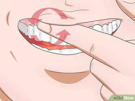 Immagine titolata Reduce Gum Swelling Step 8