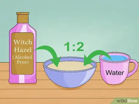 Immagine titolata Clean Your Scalp Step 7