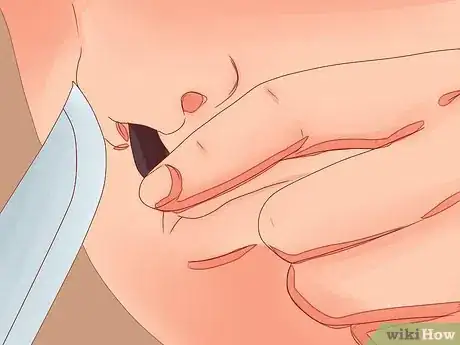 Immagine titolata Remove Leeches Step 8