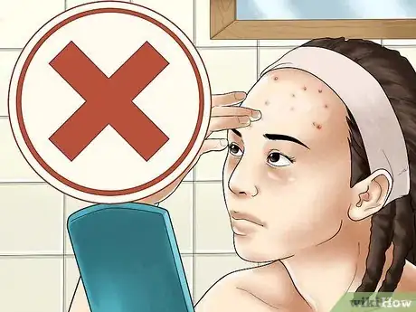 Immagine titolata Get Rid of Forehead Acne Step 17