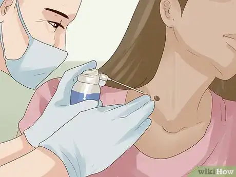Immagine titolata Get Rid of Skin Tags Step 3