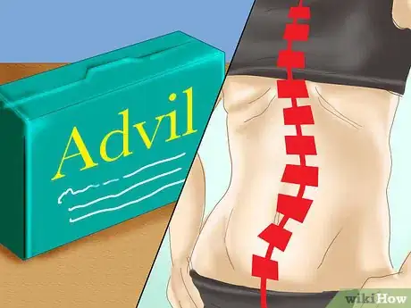 Immagine titolata Prevent Scoliosis Step 5