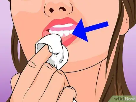 Immagine titolata Pierce Your Own Lip Step 4