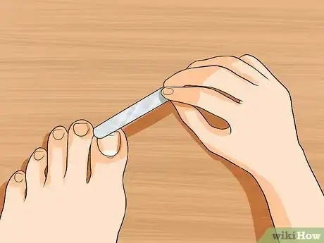 Immagine titolata Get Rid of Yellow Toenails Step 15