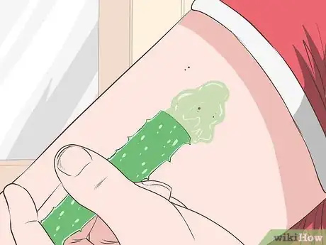 Immagine titolata Stop Mosquito Bites from Itching Step 12