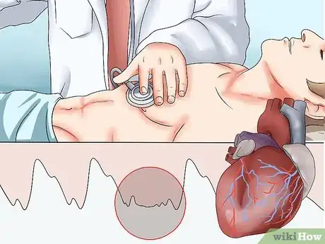 Immagine titolata Take an Apical Pulse Step 13