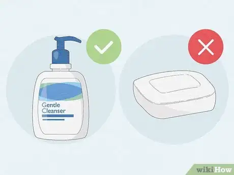 Immagine titolata Care for Your Skin As a Guy Step 2