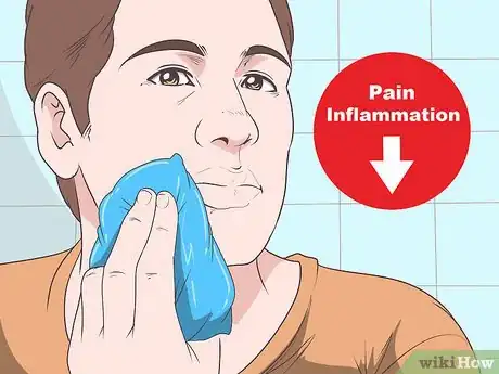 Immagine titolata Treat a Cold Sore or Fever Blisters Step 14