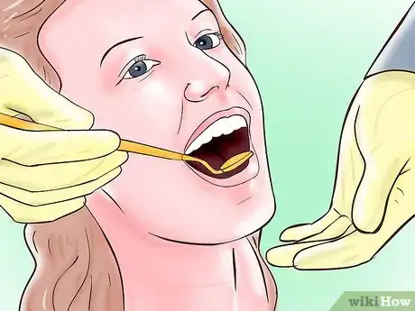 Immagine titolata Diagnose an Overbite Step 4