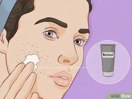 Immagine titolata Close Blackhead Holes Step 7