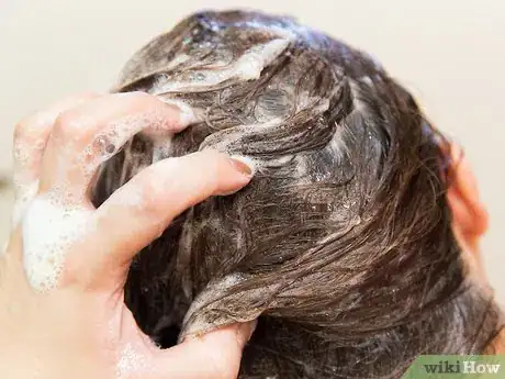 Immagine titolata Prevent and Treat Dandruff Step 8