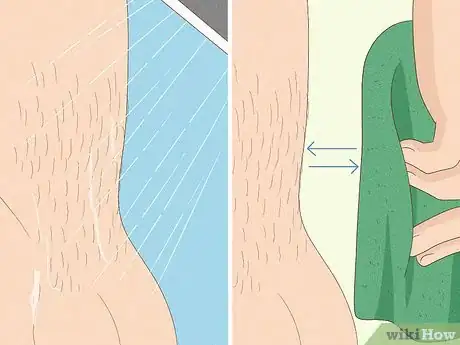 Immagine titolata Remove Male Pubic Hair Without Shaving Step 15