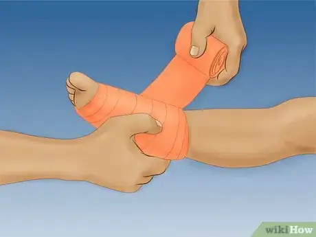 Immagine titolata Strengthen Your Ankle After a Sprain Step 4