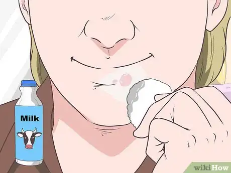 Immagine titolata Treat a Cold Sore or Fever Blisters Step 16