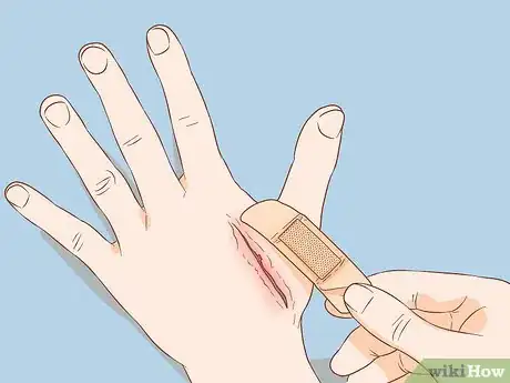 Immagine titolata Apply Different Types of Bandages Step 4