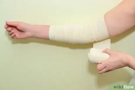 Immagine titolata Strap an Elbow Step 5