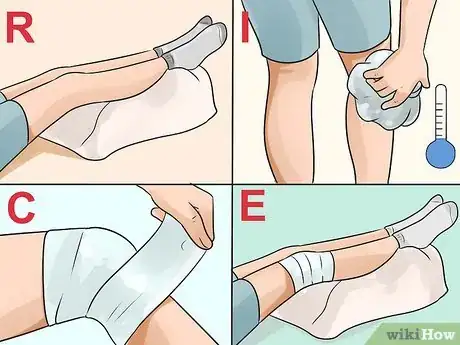 Immagine titolata Get Rid of a Cyst Step 5