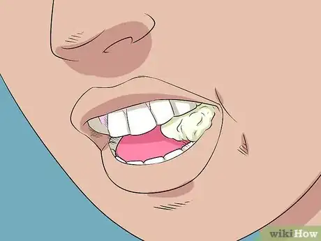 Immagine titolata Pull out a Loose Tooth Step 6