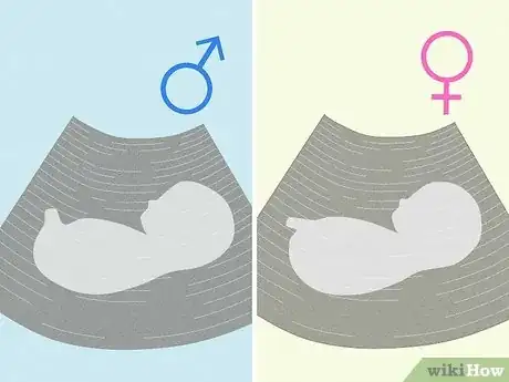 Immagine titolata Tell if You're Pregnant with a Girl or Boy Step 19