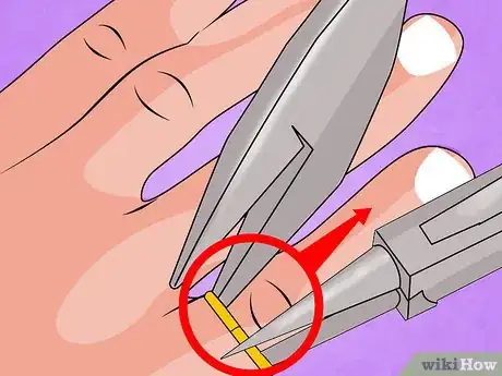 Immagine titolata Treat a Broken Finger Step 7