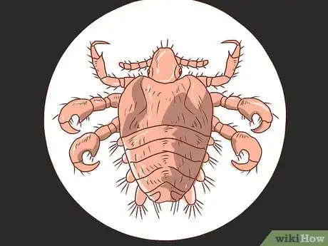 Immagine titolata Treat Crabs (Pubic Lice) Step 1