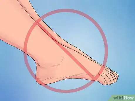 Immagine titolata Treat Plantar Fasciitis Step 14