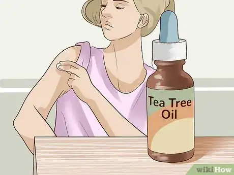 Immagine titolata Get Rid of Skin Tags Step 9