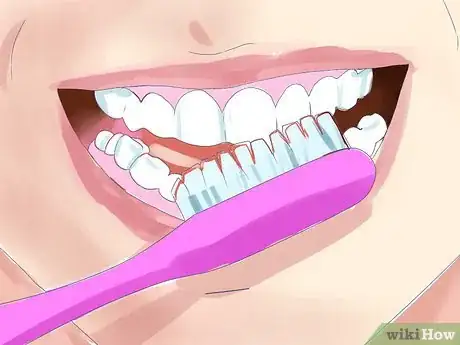 Immagine titolata Bite Someone's Lip Step 13
