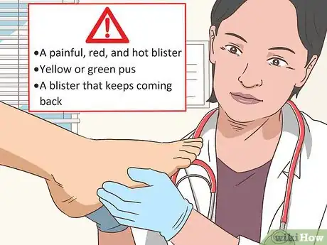 Immagine titolata Treat a Foot Blister Step 12