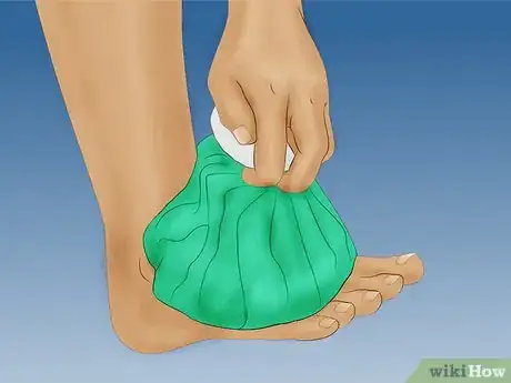 Immagine titolata Strengthen Your Ankle After a Sprain Step 3
