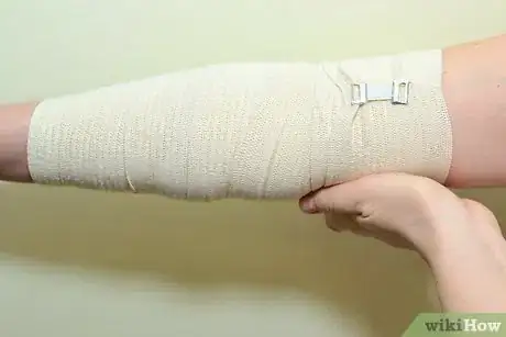 Immagine titolata Strap an Elbow Step 6