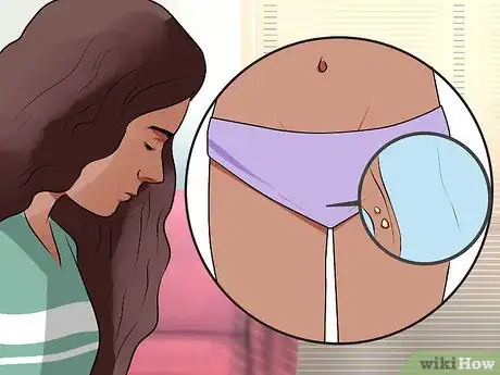 Immagine titolata Recognize Vulva Cancer Symptoms Step 3