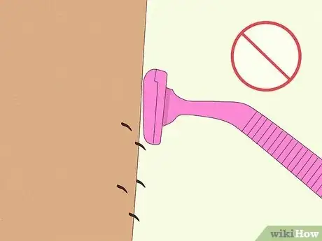 Immagine titolata Prevent Ingrown Hairs After Waxing Using Home Remedies Step 10