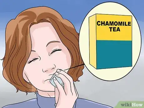 Immagine titolata Stop a Mouth Ulcer from Hurting Step 10