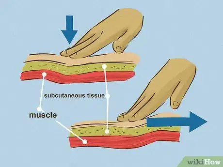 Immagine titolata Give an Intramuscular Injection Step 15