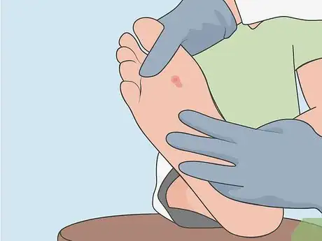 Immagine titolata Treat a Puncture Wound Step 6