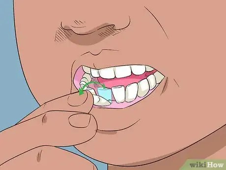 Immagine titolata Pull out a Loose Tooth Step 1