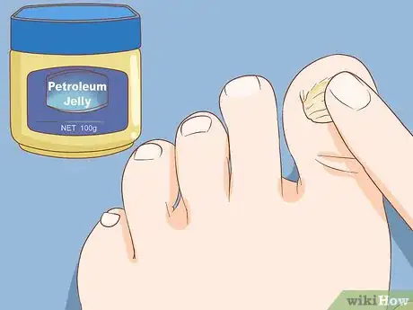 Immagine titolata Help a Toenail Grow Back Quickly Step 6