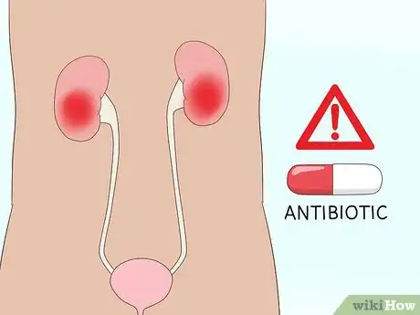 Immagine titolata Bring Down High Creatinine Levels Step 15