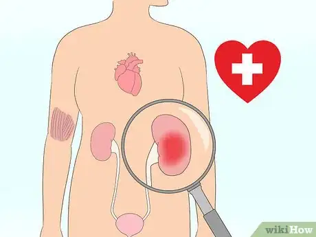 Immagine titolata Bring Down High Creatinine Levels Step 17