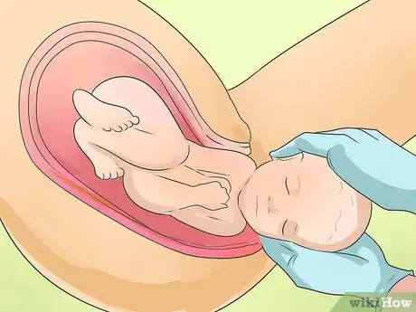 Immagine titolata Deliver a Baby Step 9