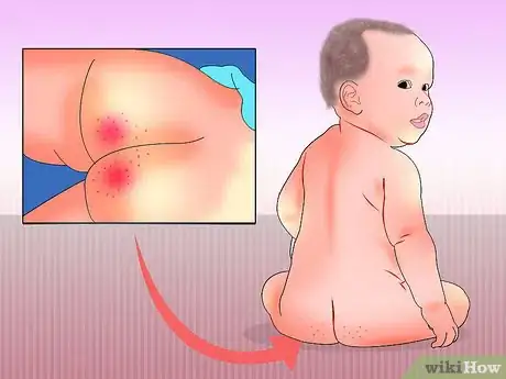 Immagine titolata Treat Diarrhea in Newborns Step 15