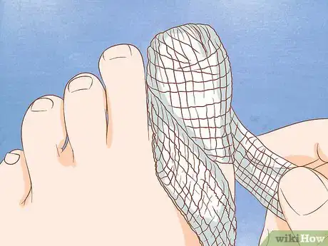 Immagine titolata Help a Toenail Grow Back Quickly Step 2