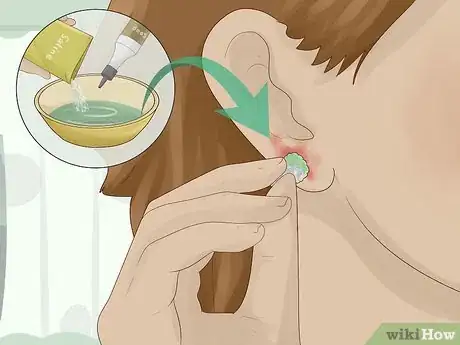 Immagine titolata Clean an Infected Ear Piercing Step 3